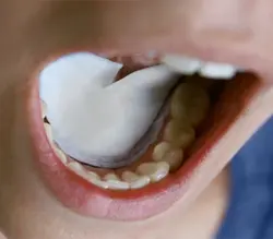 پد جذب رطوبت و بزاق دهان زیرزبانی Brilliant – DryDent