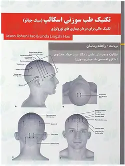 کتاب تکنیک طب سوزنی اسکالپ