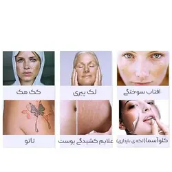 دستگاه لیزر موهای زائد دایود و حذف تاتو پیکوشور پیکوثانیه - فروشگاه ققنوس