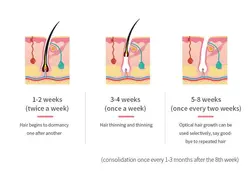 دستگاه لیزر خانگی حذف موی زائد صورت و بدن Hair Removal Device - فروشگاه ققنوس