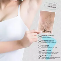 دستگاه لیزر خانگی حذف موی زائد صورت و بدن Hair Removal Device - فروشگاه ققنوس