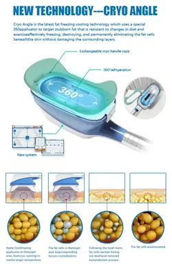 خرید و قیمت دستگاه لاغری کرایو لیپو لیزر360 درجه  ققنوس شاپ.