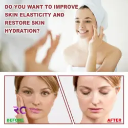 پد کلاژن ساز جذبی رجیون