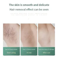 دستگاه لیزر خانگی موهای زائد یک میلیون شات IPL