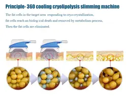 دستگاه لاغری کرایو لیپو لیزر360 درجه - هدیه بیوتی