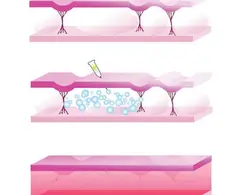 دستگاه کربوکسی تراپی مدایون با 1 سال گارانتی MEDAION - هدیه بیوتی
