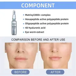 ویال ضدجوش نیاسامید - هدیه بیوتی