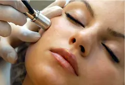 دستگاه جوانسازی و حذف جوش های صورت هیدرودرمی (