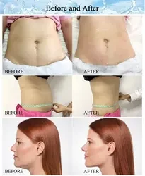 دستگاه لاغری و کاهش وزن دارای 4 هندپیس اخصاصی (