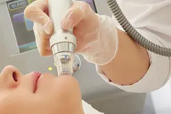 دستگاه میکرونیدلینگ برای جوانسازی پوست مدل (