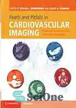 دانلود کتاب Pearls and pitfalls in cardiovascular imaging : pseudolesions, artifacts and other difficult diagnoses - مرواریدها و مشکلات در تصویربرداری قلبی عروقی: ضایعات کاذب، مصنوعات و سایر تشخیص های دشوار - سای وان | SciOne