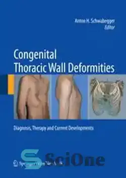 دانلود کتاب Congenital Thoracic Wall Deformities: Diagnosis, Therapy and Current Developments - ناهنجاری های مادرزادی دیواره قفسه سینه: تشخیص، درمان و تحولات فعلی - سای وان | SciOne