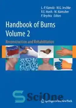دانلود کتاب Handbook of Burns: Reconstruction and Rehabilitation Volume 2 - کتاب راهنمای سوختگی: بازسازی و توانبخشی جلد 2 - سای وان | SciOne