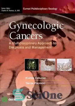 دانلود کتاب Gynecologic Cancers A. Multidisciplinary Approach to Diagnosis and Management - سرطان های زنان A. رویکرد چند رشته ای به تشخیص و مدیریت