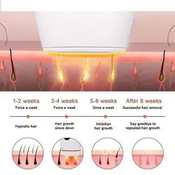 لیزر موهای زائد دائمی و حرفه ای 900 هزار شات ( پالس ) IPL