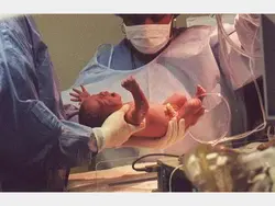 پاورپوینت مکانیسم زایمان طبیعی در نمایش اکسی پوت