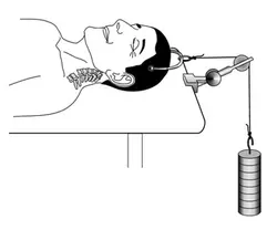 پاورپوینت بیمار تحت تراکشن