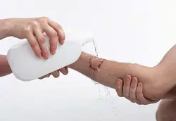 پاورپوینت مراقبت از زخم Wound Care