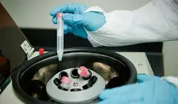 پاورپوینت سانتریفیوژ Centrifuge