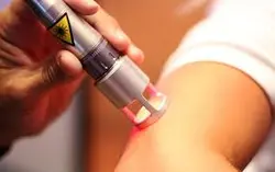 دانلودتحقیق درمورد لیزر درمانی و فیزیوتراپی