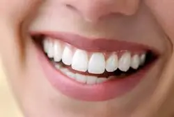 پاورپوینت مواد دندانهای مصنوعی Denture teeth materials