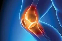 پاورپوینت پروتكل‌هاي تشخيصي درماني آسيب‌هاي ورزشي زانو