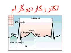 پاورپوینت سکته قلبی و مانیتورینگ بیمار
